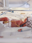 Quintuplets Born In Krakow, Poland