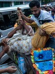 Injured People Being Carried To Dhaka Medical College For Treatment