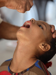 Palestinian Child Receives Polio Vaccine at UK-MED Hospital in Gaza Amid Ongoing Conflict