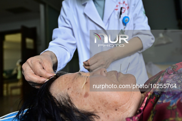 

A medical worker is giving acupuncture treatment to a citizen in the rehabilitation Department of Traditional Chinese Medicine at Qingzhou...