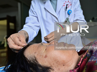 

A medical worker is giving acupuncture treatment to a citizen in the rehabilitation Department of Traditional Chinese Medicine at Qingzhou...