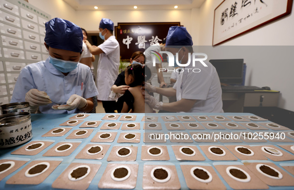 

A doctor at a traditional Chinese medicine clinic is applying "Sanfu stickers" to a child in Zaozhuang, Shandong Province, China on July 1...