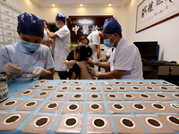 

A doctor at a traditional Chinese medicine clinic is applying "Sanfu stickers" to a child in Zaozhuang, Shandong Province, China on July 1...