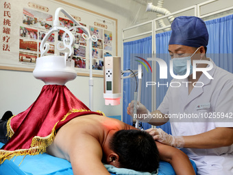 

A doctor at a traditional Chinese medicine clinic is performing suspension moxibustion and pot moxibustion treatments for citizens in Zaoz...