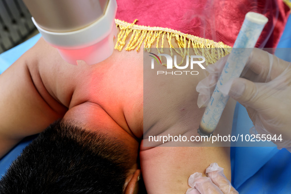 

A doctor at a traditional Chinese medicine clinic is performing suspension moxibustion and pot moxibustion treatment for citizens in Zaozh...