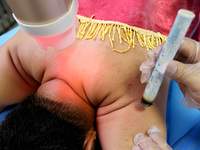 

A doctor at a traditional Chinese medicine clinic is performing suspension moxibustion and pot moxibustion treatment for citizens in Zaozh...