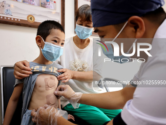 

A doctor at a traditional Chinese medicine clinic is applying "Sanfu stickers" to a child in Zaozhuang, Shandong Province, China on July 1...