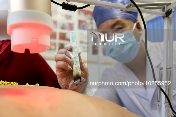 

A doctor at a traditional Chinese medicine clinic is performing suspension moxibustion and pot moxibustion treatment for citizens in Zaozh...