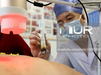 

A doctor at a traditional Chinese medicine clinic is performing suspension moxibustion and pot moxibustion treatment for citizens in Zaozh...