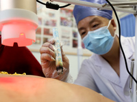 

A doctor at a traditional Chinese medicine clinic is performing suspension moxibustion and pot moxibustion treatment for citizens in Zaozh...