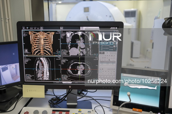 A General view showing a display screen showing a CT Scan inside the Central Government-aided Emergency Hospital on July 11, 2023 in Hong Ko...