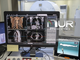 A General view showing a display screen showing a CT Scan inside the Central Government-aided Emergency Hospital on July 11, 2023 in Hong Ko...