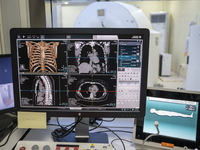 A General view showing a display screen showing a CT Scan inside the Central Government-aided Emergency Hospital on July 11, 2023 in Hong Ko...