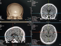 A General view showing a display screen showing a CT Scan of a brain inside the Central Government-aided Emergency Hospital on July 11, 2023...