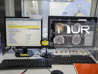 A General view showing a display screen showing a CT Scan inside the Central Government-aided Emergency Hospital on July 11, 2023 in Hong Ko...