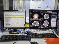 A General view showing a display screen showing a CT Scan inside the Central Government-aided Emergency Hospital on July 11, 2023 in Hong Ko...