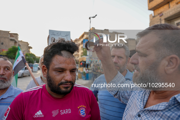 Solidarity with cancer patients in Afrin, northwestern Syria,on july 23, 2023,  as they shave their hair in support of cancer patients exper...