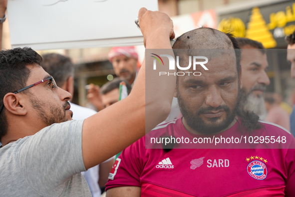 Solidarity with cancer patients in Afrin, northwestern Syria,on july 23, 2023,  as they shave their hair in support of cancer patients exper...