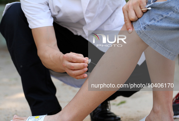 LINYI, CHINA - AUGUST 25, 2023 - A doctor performs balanced acupuncture for villagers in Linyi city, Shandong province, Aug 25, 2023. Throug...