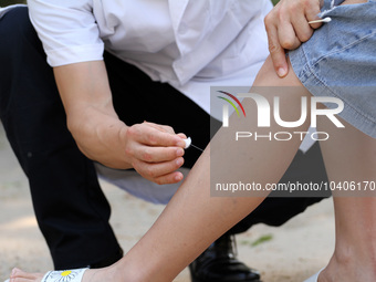 LINYI, CHINA - AUGUST 25, 2023 - A doctor performs balanced acupuncture for villagers in Linyi city, Shandong province, Aug 25, 2023. Throug...