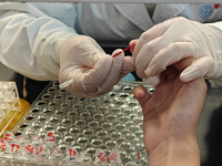 SHANGHAI, CHINA - NOVEMBER 14, 2023 - A doctor draws blood from a patient's finger at a hospital emergency department in Shanghai, China, No...