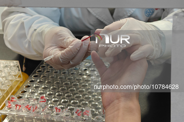 SHANGHAI, CHINA - NOVEMBER 14, 2023 - A doctor draws blood from a patient's finger at a hospital emergency department in Shanghai, China, No...