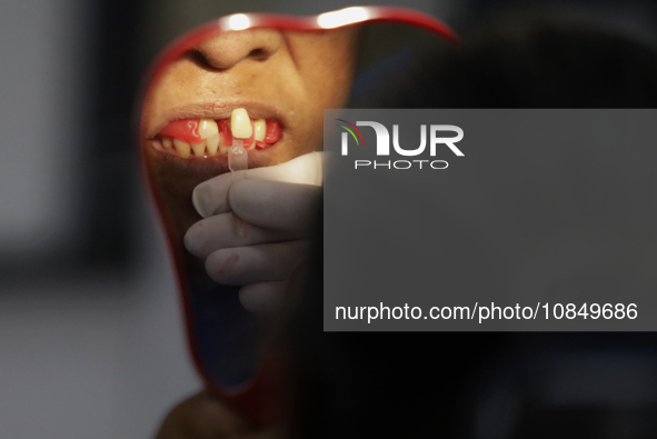 A dentist at the Centro de Odontogeriatria TIII Doctor Guillermo Roman y Carrillo, located in the Iztapalapa district of Mexico City, is att...