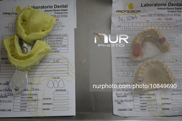 Dental impressions are being viewed inside the Centro de Odontogeriatria Centro de Salud TIII Doctor Guillermo Roman y Carrillo, located in...