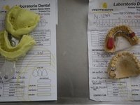 Dental impressions are being viewed inside the Centro de Odontogeriatria Centro de Salud TIII Doctor Guillermo Roman y Carrillo, located in...