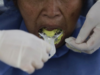 A dentist at the Centro de Salud TIII Doctor Guillermo Roman y Carrillo in the Iztapalapa district of Mexico City is attending to an older a...