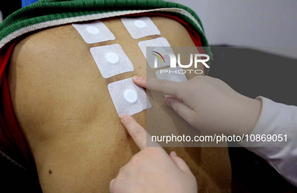 People are posting ''Sanjiu stickers'' at the Traditional Chinese Medicine Hall of Oriental Hospital in Lianyungang, East China's Jiangsu pr...