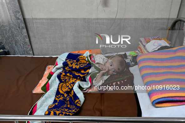 A baby is receiving treatment for pneumonia inside Dhaka Child Hospital during the winter season in Dhaka, Bangladesh, on January 15, 2024. 