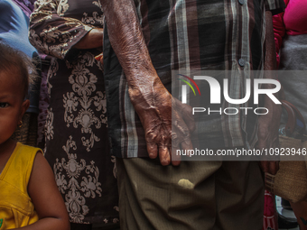 A child is seen within the leper community mass, which is protesting against the stigma and neglect at the North Sumatra Governor's office i...