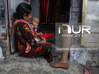 A leper woman is caring for her daughter at the Sicanang leprosy settlement in Medan, North Sumatra Province, Indonesia, on February 24, 201...