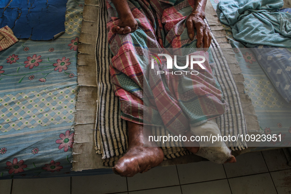 A person with leprosy is praying during their hospitalization at Sicanang Leprosy Special Hospital in Medan, North Sumatra Province, Indones...