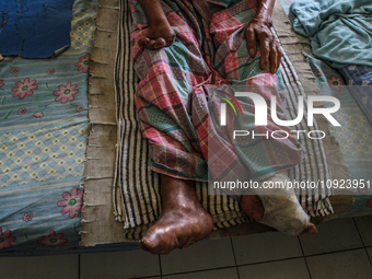 A person with leprosy is praying during their hospitalization at Sicanang Leprosy Special Hospital in Medan, North Sumatra Province, Indones...