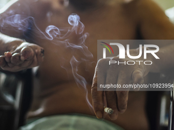 A patient with leprosy is smoking cigarettes during their hospitalization at Sicanang Leprosy Special Hospital in Medan, North Sumatra Provi...