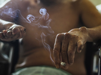 A patient with leprosy is smoking cigarettes during their hospitalization at Sicanang Leprosy Special Hospital in Medan, North Sumatra Provi...