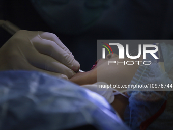 A child is receiving pediatric dental care as part of Dentist Day in Mexico at the Carlos A. Carrilo Elementary School in the Portales neigh...