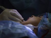 A child is receiving pediatric dental care as part of Dentist Day in Mexico at the Carlos A. Carrilo Elementary School in the Portales neigh...