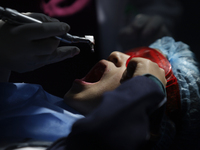 A child is receiving pediatric dental care as part of Dentist Day in Mexico at the Carlos A. Carrilo Elementary School in the Portales neigh...