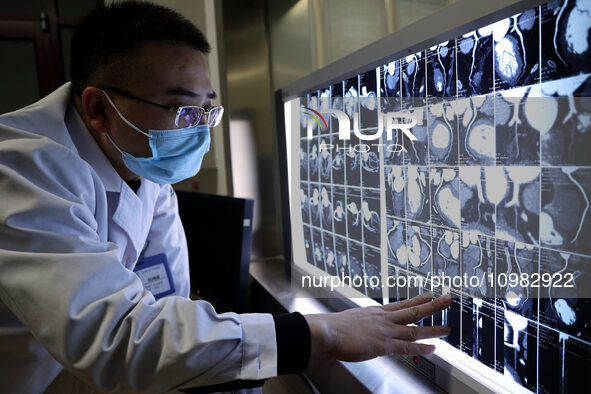 A doctor is checking a patient's CT scan at the imaging department of Boxing County Traditional Chinese Medicine Hospital in Binzhou, China,...