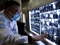 A doctor is checking a patient's CT scan at the imaging department of Boxing County Traditional Chinese Medicine Hospital in Binzhou, China,...