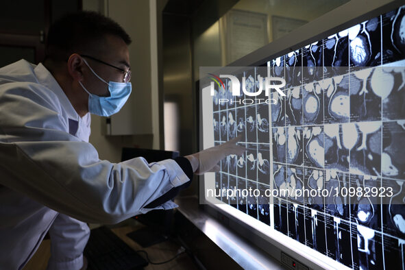 A doctor is checking a patient's CT scan in the imaging department of Boxing County Traditional Chinese Medicine Hospital in Binzhou, China,...