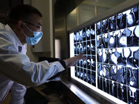 A doctor is checking a patient's CT scan in the imaging department of Boxing County Traditional Chinese Medicine Hospital in Binzhou, China,...