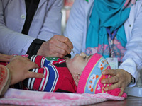 A health worker is administering polio vaccine drops to a child in Srinagar, Kashmir, India, on March 3, 2024. A three-day pulse polio vacci...