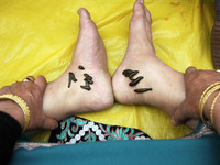 A local practitioner is placing leeches on the feet of a woman to suck impure blood as a means of skin treatment in celebration of Nowruz, t...