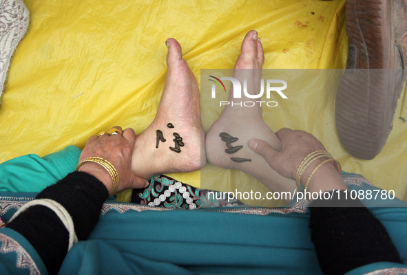 A local practitioner is placing leeches on the feet of a woman to suck impure blood as a means of skin treatment in celebration of Nowruz, t...