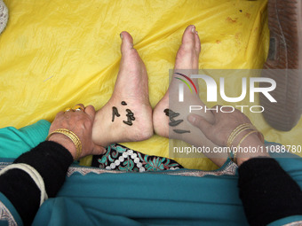 A local practitioner is placing leeches on the feet of a woman to suck impure blood as a means of skin treatment in celebration of Nowruz, t...