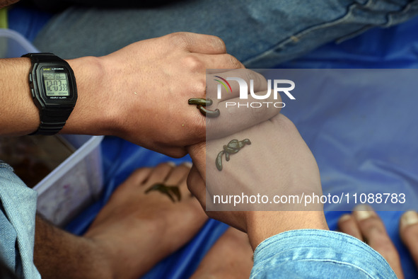 A local practitioner is placing leeches on the hands and feet of a man to suck impure blood as a means of skin treatment in celebration of N...